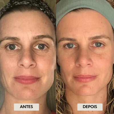 Eleva™ Sculpt PRO - Massageador EMS & Drenagem Facial + Protocolo Drenagem Coreana (Bônus)